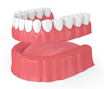 Traditional dentures