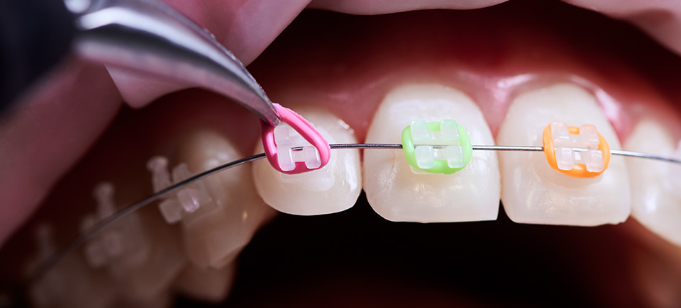 Orthodontics Dental Care