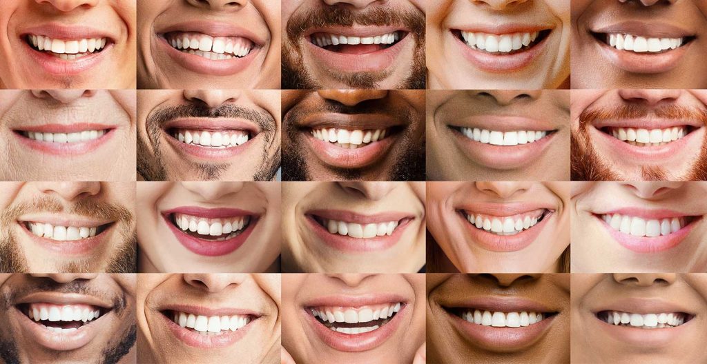 Full Mouth Reconstruction vs Smile Makeover