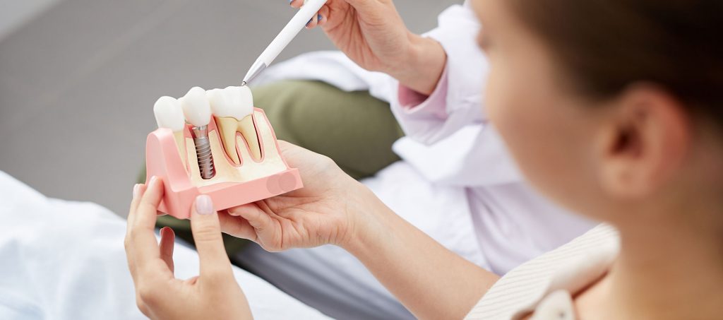 Dentist explaining patients of benefits of dental implants