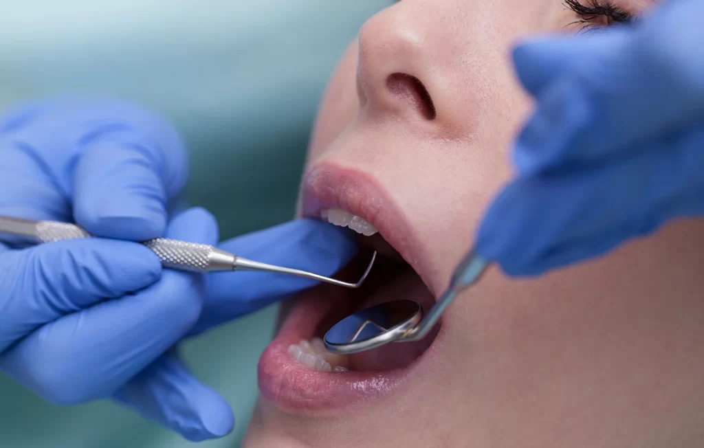 Dentist checking patients dental fillings