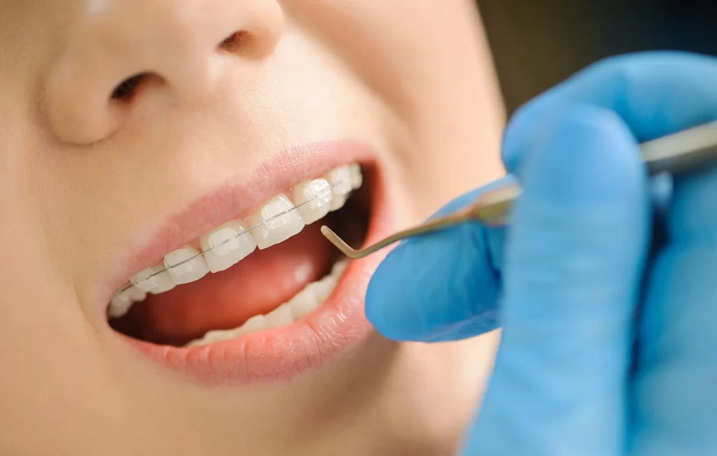 Dental checkup for patients with braces in South Gate, CA